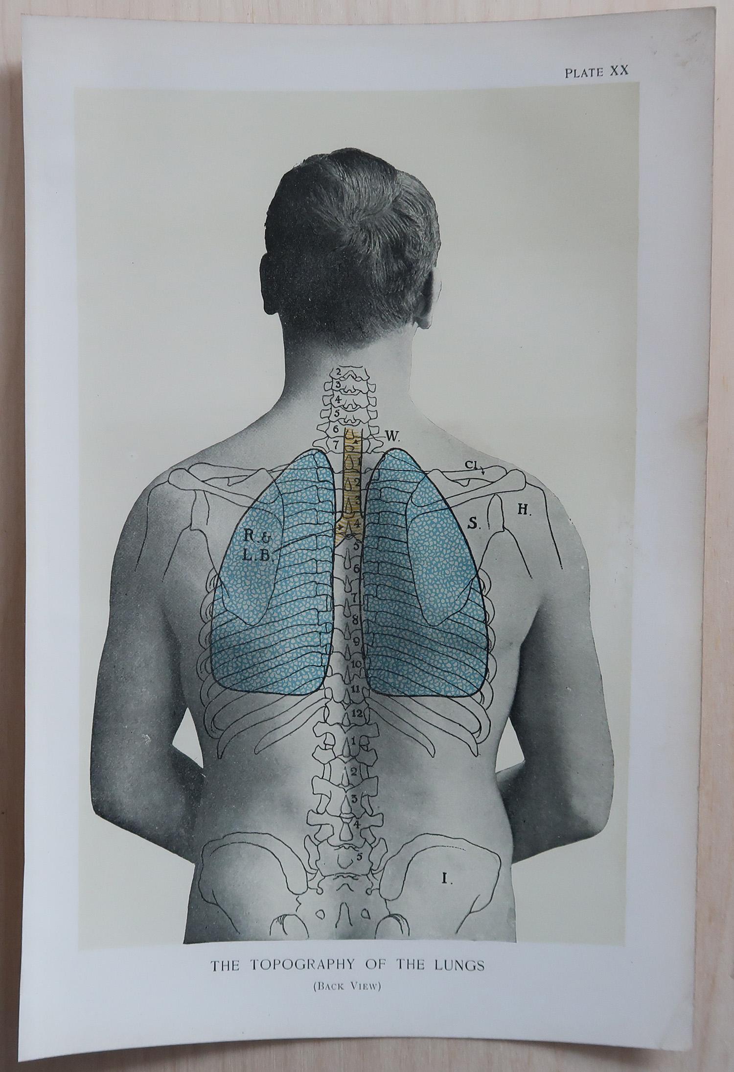 Edoardiano Set di 8 stampe mediche originali d'epoca, circa 1900 in vendita