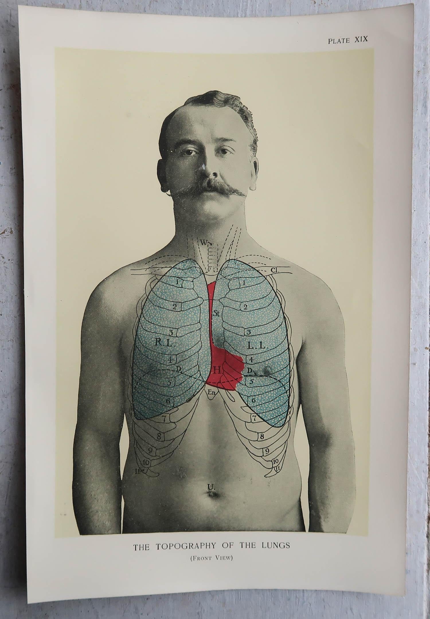 Anglais Ensemble de 8 estampes médicales originales vintage, vers 1900