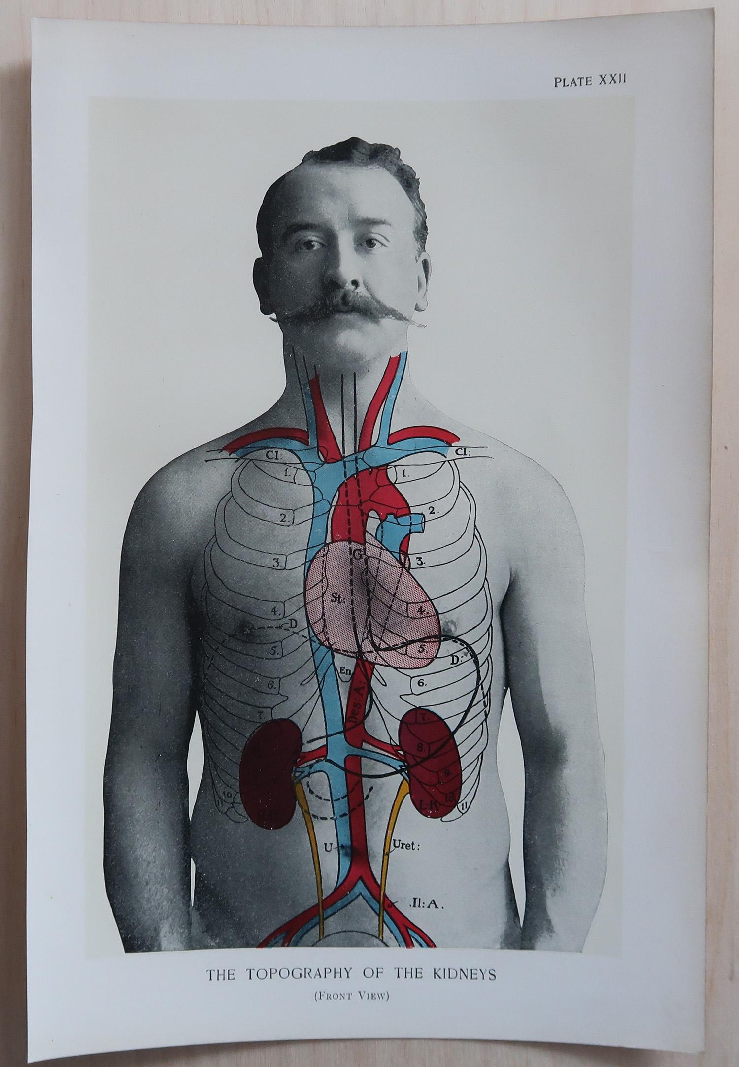 Inglese Set di 8 stampe mediche originali d'epoca, circa 1900 in vendita