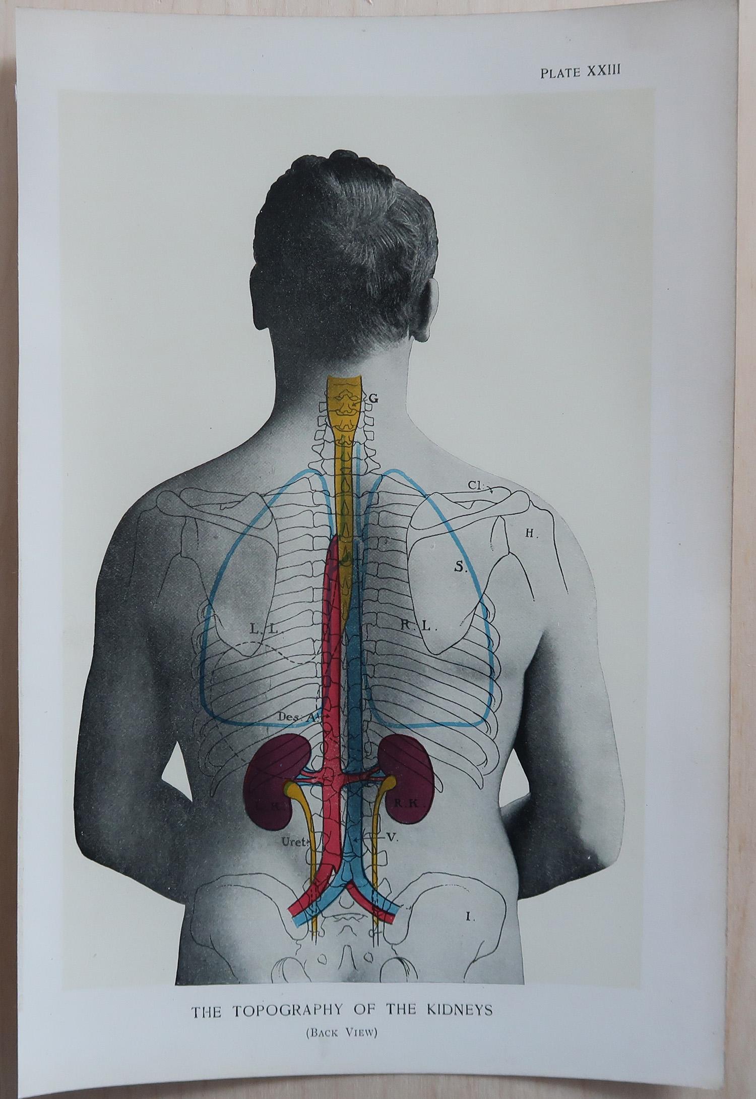 Altro Set di 8 stampe mediche originali d'epoca, circa 1900 in vendita