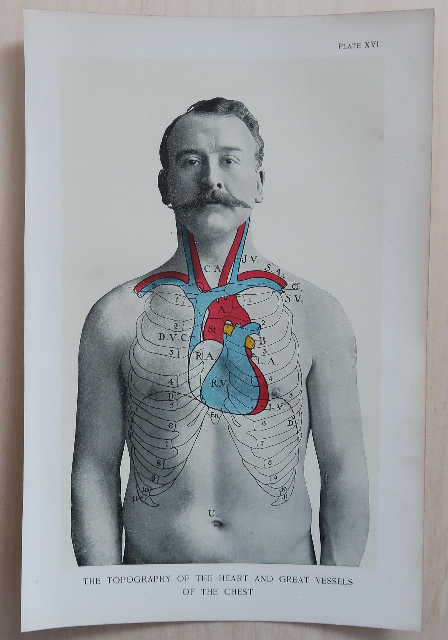 Set di 8 stampe mediche originali d'epoca, circa 1900 In condizioni buone in vendita a St Annes, Lancashire