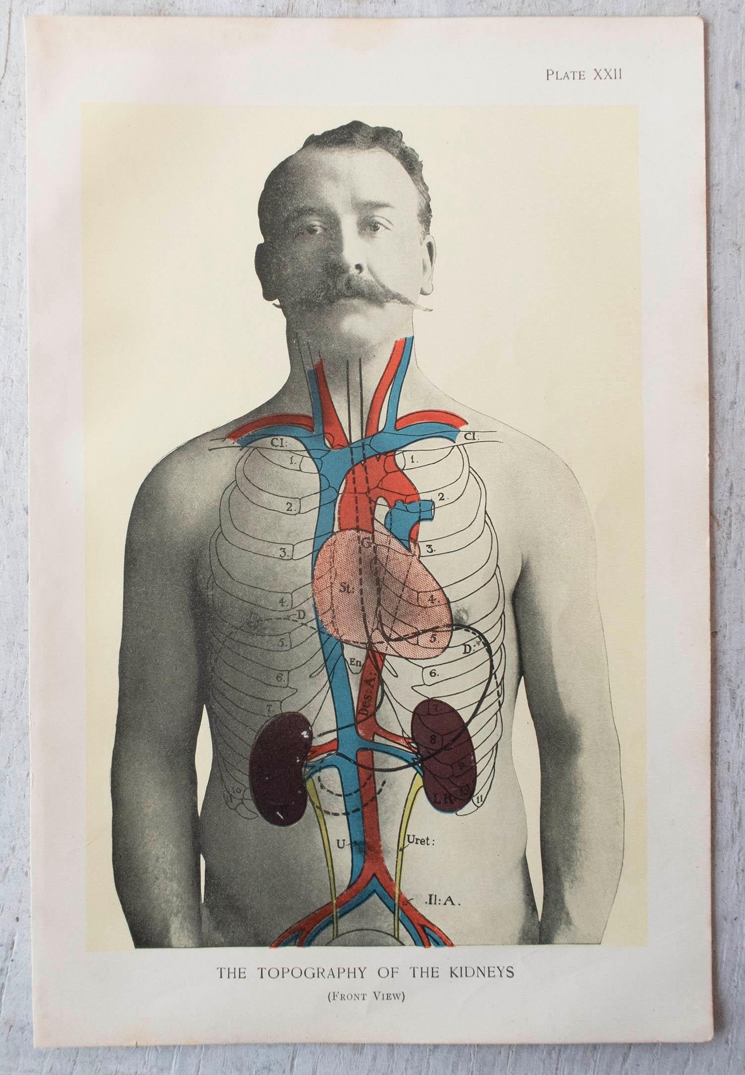 Early 20th Century Set of 8 Original Vintage Medical Prints, circa 1900 For Sale