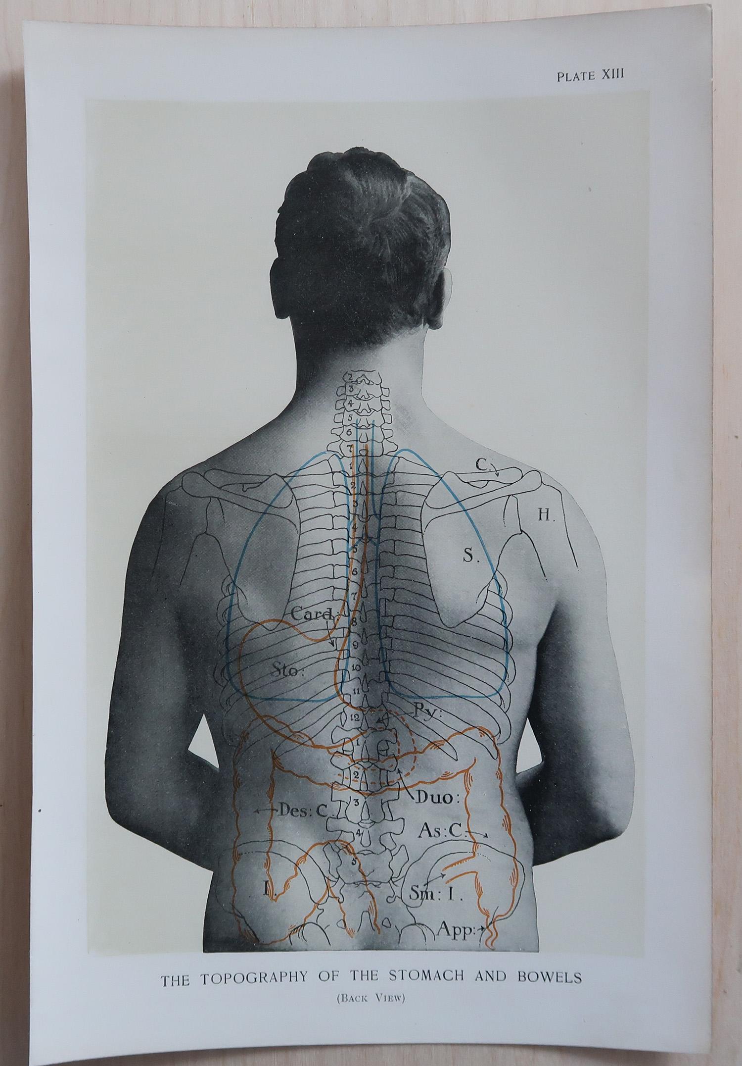 Inizio XX secolo Set di 8 stampe mediche originali d'epoca, circa 1900 in vendita