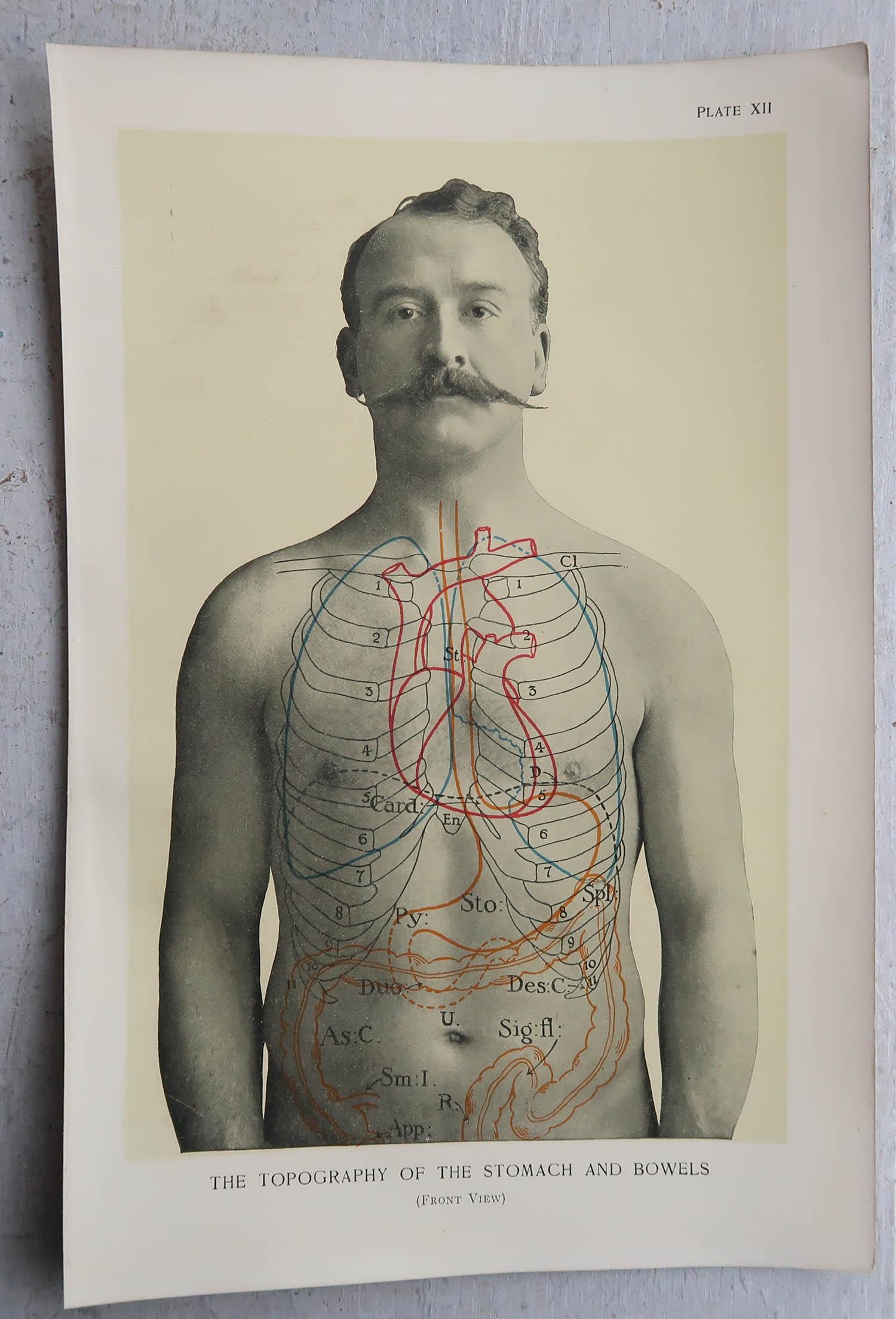 Début du 20ème siècle Ensemble de 8 estampes médicales originales vintage, vers 1900