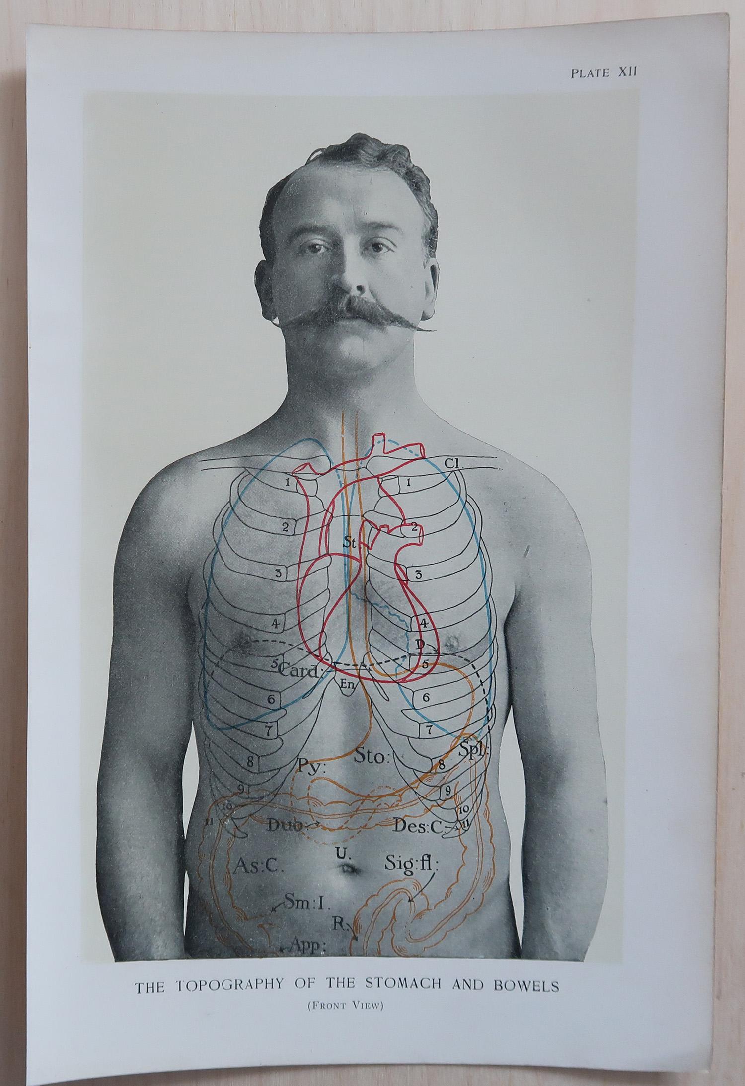 Carta Set di 8 stampe mediche originali d'epoca, circa 1900 in vendita