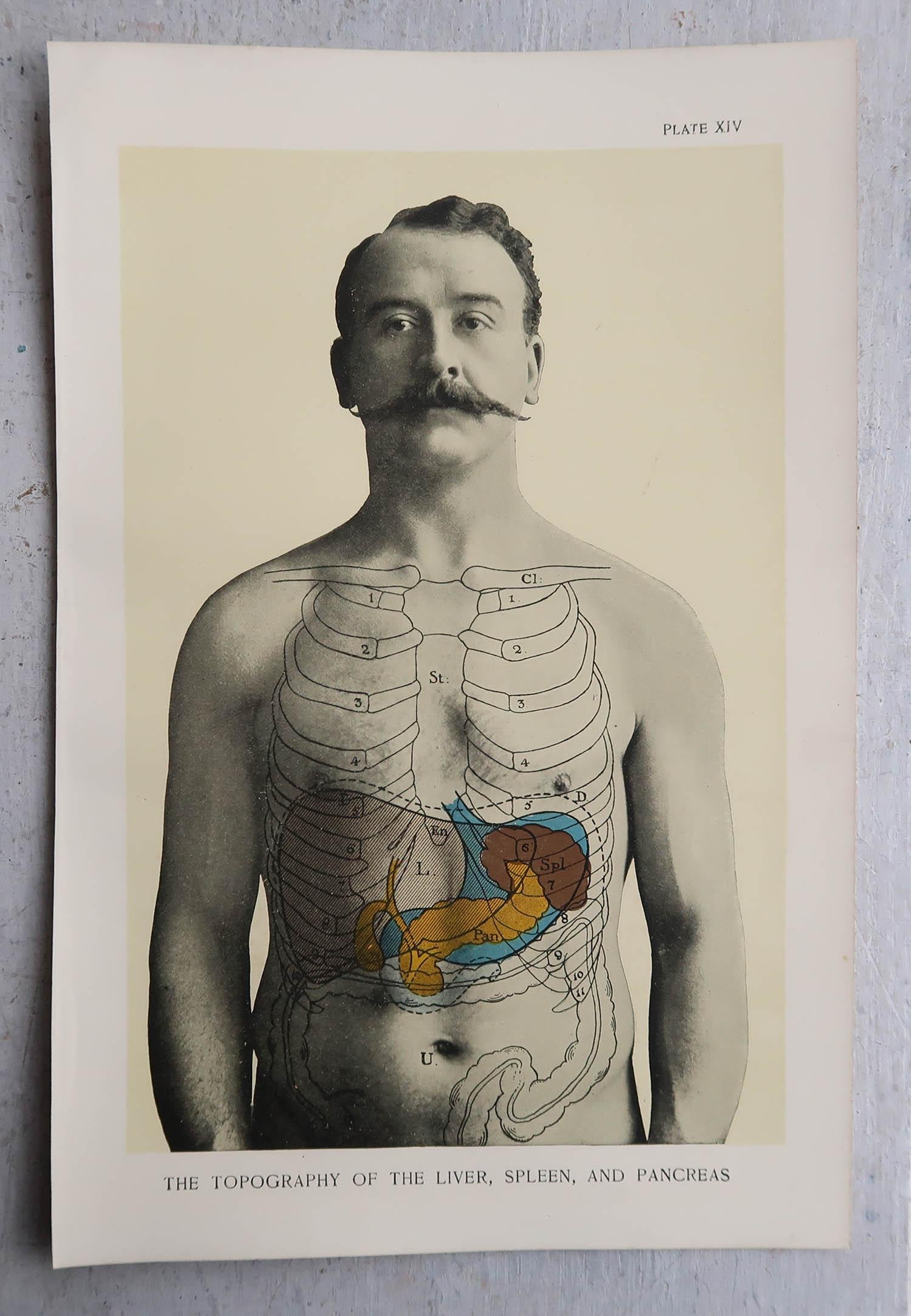 Papier Ensemble de 8 estampes médicales originales vintage, vers 1900