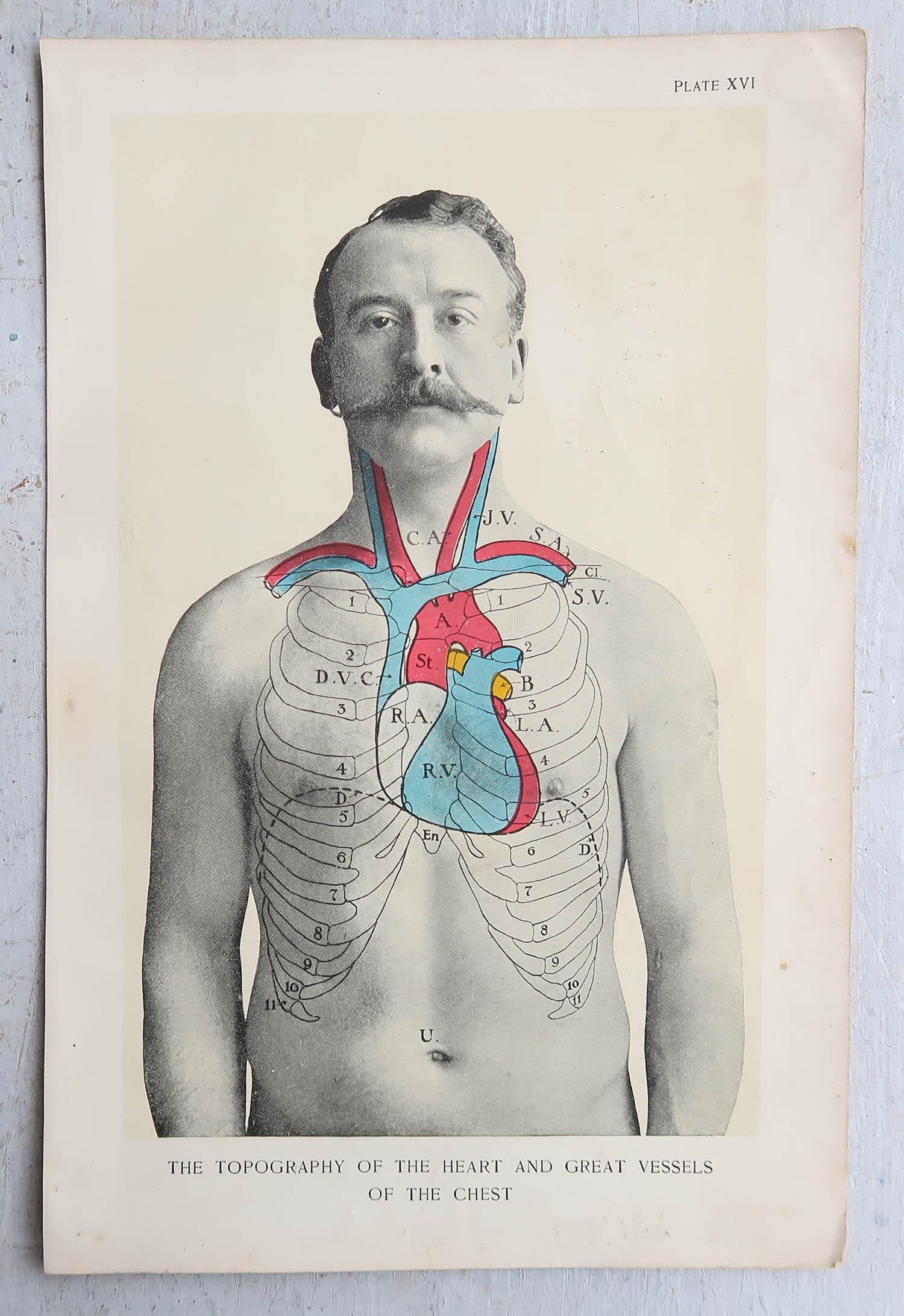 Ensemble de 8 estampes médicales originales vintage, vers 1900 1