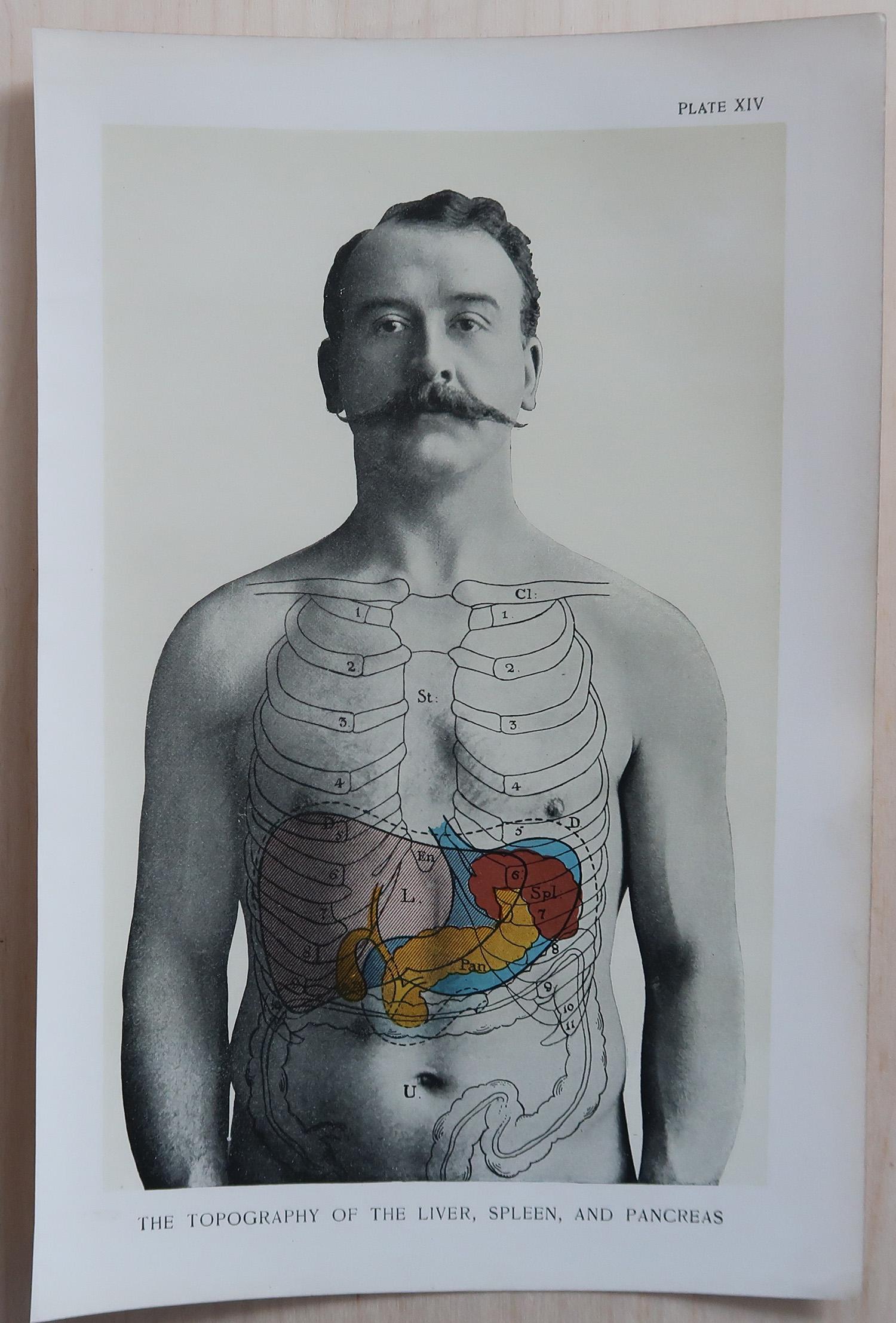 Set di 8 stampe mediche originali d'epoca, circa 1900 in vendita 1