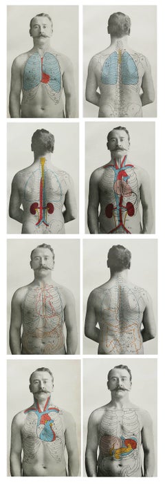 Set of 8 Original Vintage Medical Prints, circa 1900