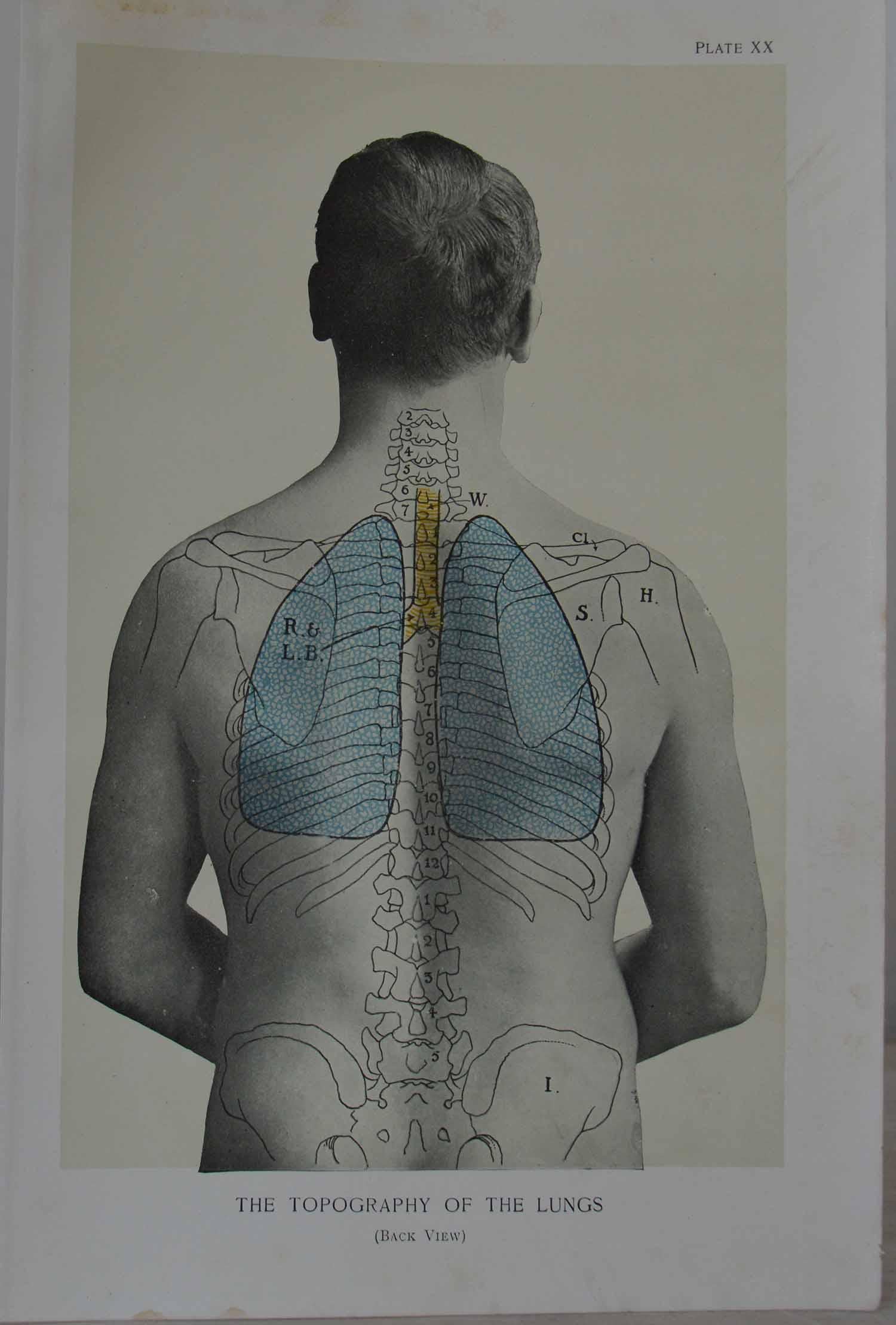 Fabulous set of 8 figural medical prints.

Unframed.

Published, circa 1900.



 