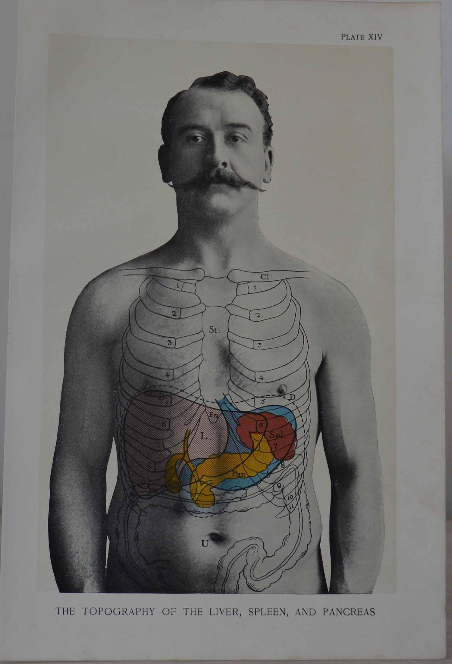 Other Set of 8 Original Vintage Medical Prints. Circa 1900.