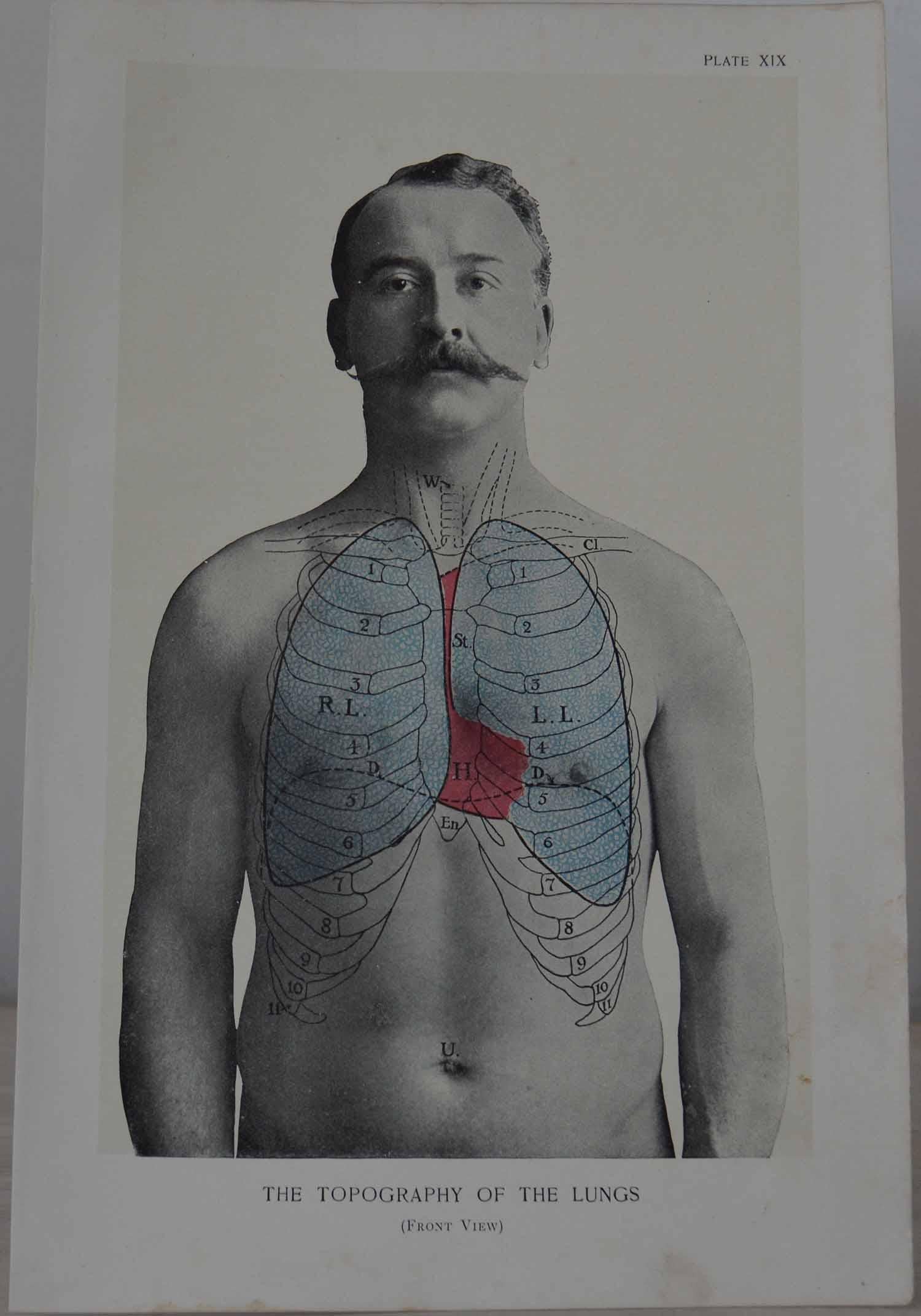 Set of 8 Original Vintage Medical Prints. Circa 1900. In Good Condition In St Annes, Lancashire