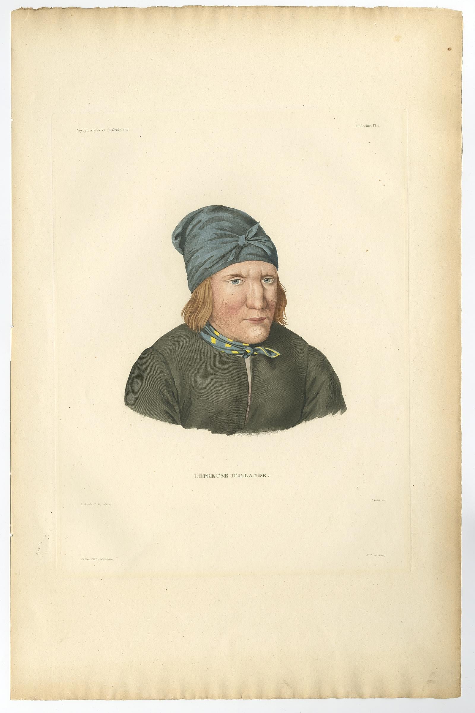 Set di tre litografie antiche di lebbrosi dall'Islanda - Gaimard Voyage, 1842 In condizioni buone in vendita a Langweer, NL