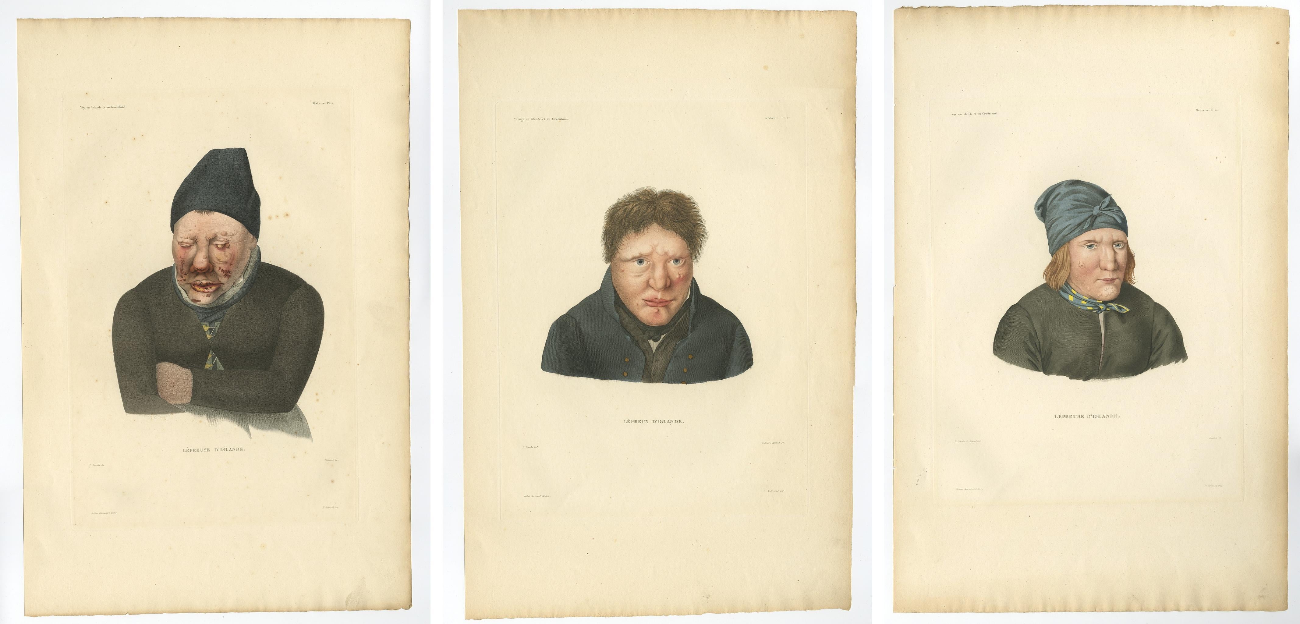 XIX secolo Set di tre litografie antiche di lebbrosi dall'Islanda - Gaimard Voyage, 1842 in vendita