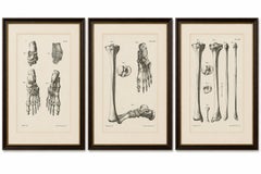 Set of Three Original French Anatomical Foot and Lower Limb Lithographs, 1821