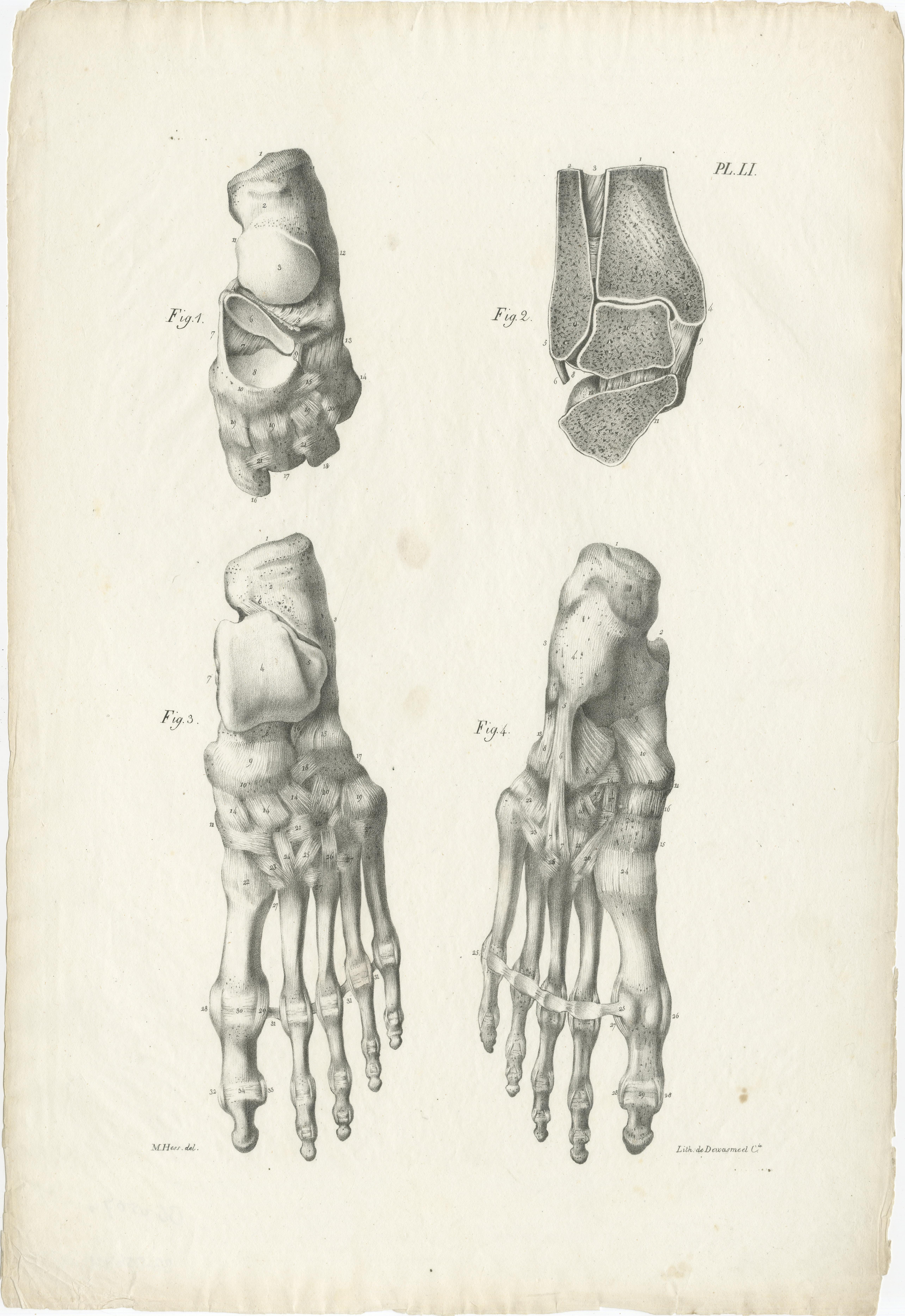 Set of Three Original French Anatomical Foot and Lower Limb Lithographs, 1821