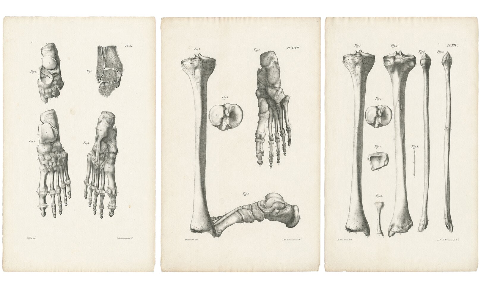 Set of Three Original French Anatomical Foot and Lower Limb Lithographs, 1821
