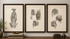 Set of Three Original French Anatomical Lithographs of the Spine and Pelvis 1821