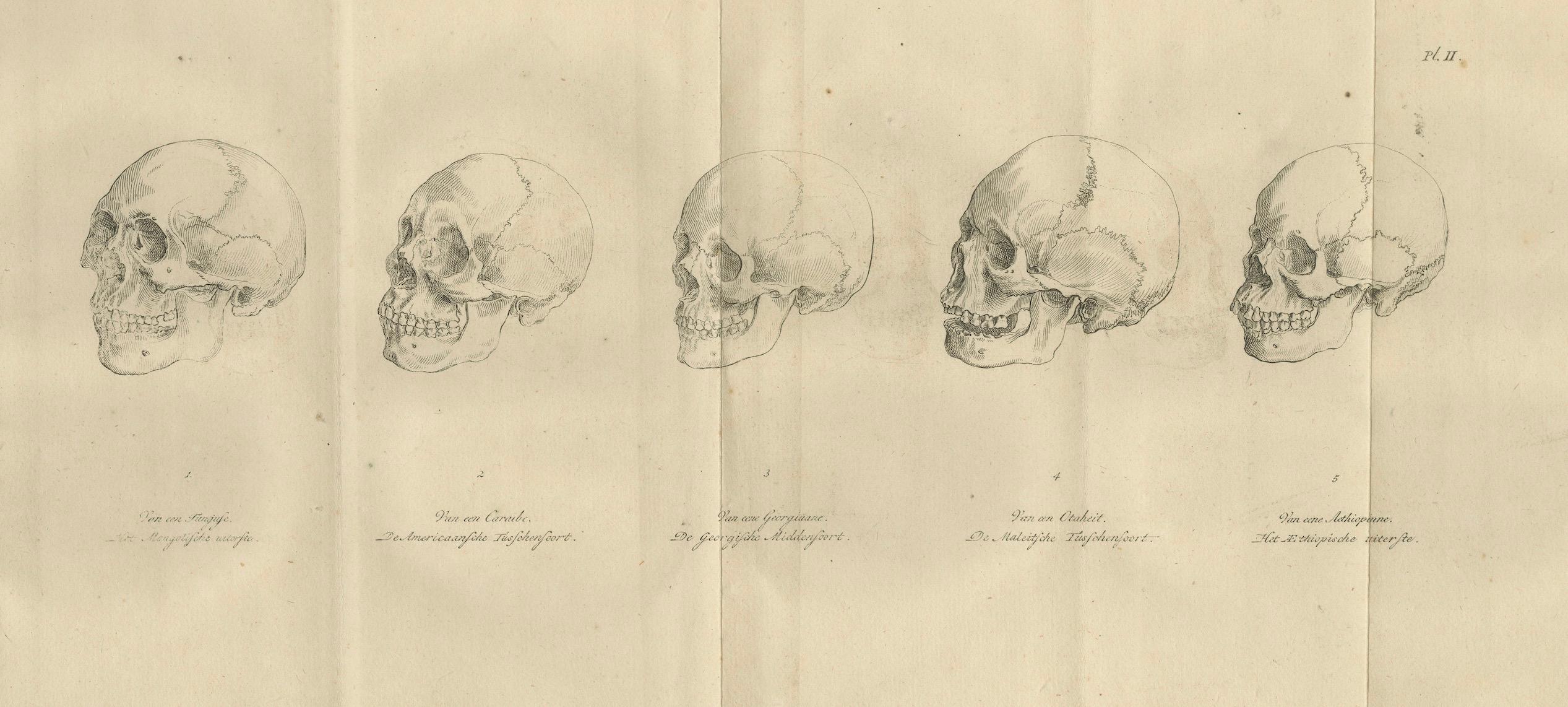 Néerlandais Ensemble de deux gravures anatomiques de crânes humains - Crâniologie comparée, 1803 en vente