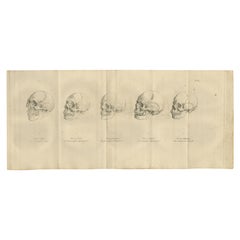 Set of Two Anatomical Engravings of Human Skulls – Comparative Craniology, 1803