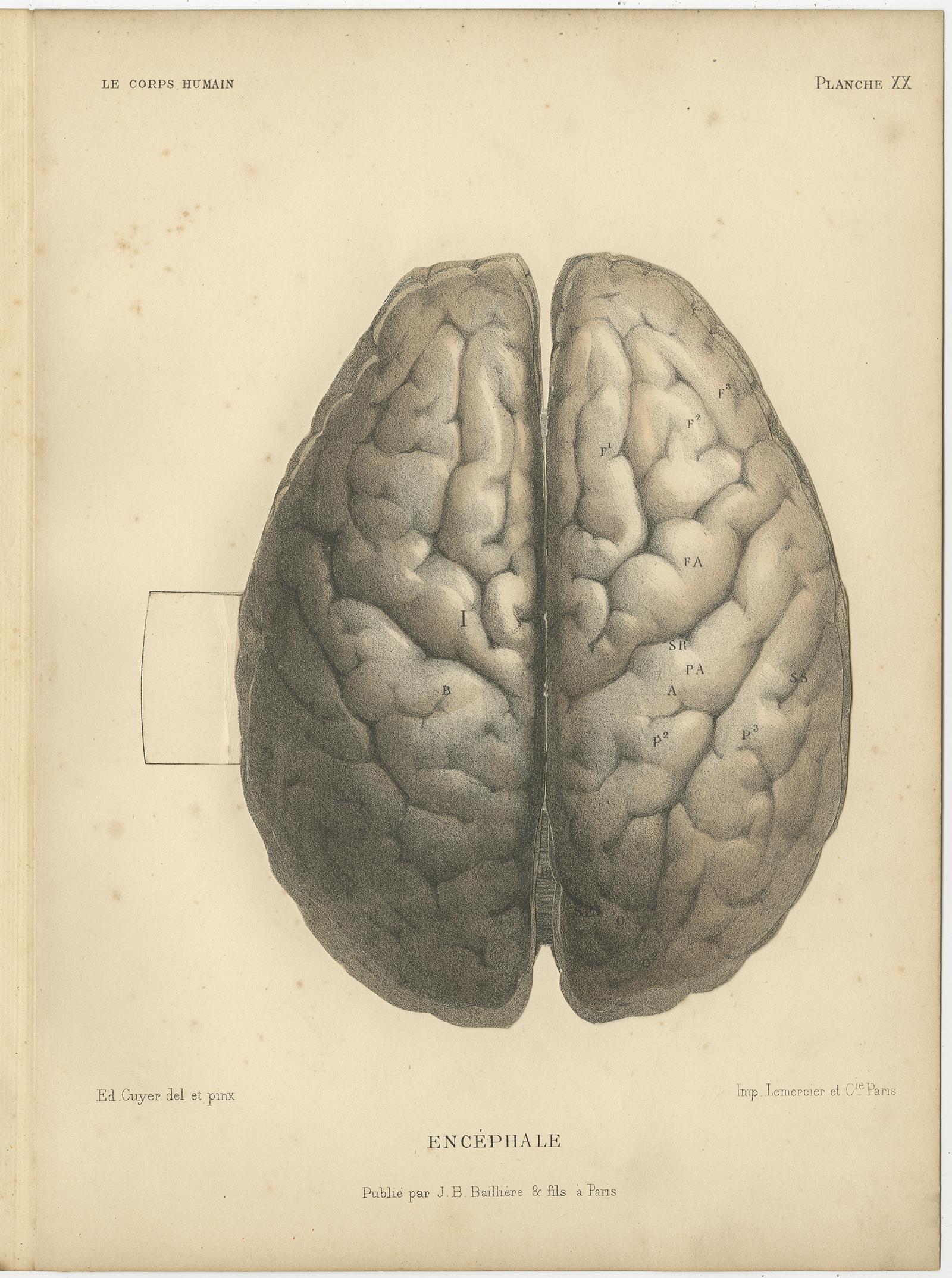 Set of two antique anatomy prints titled Encéphale' and 'L'Encéphale Face Latérale - Cervelet'. Colored lithographs of human brains with superimposed flaps. These prints originate from 'Le Corps Humain' by G.A. Kuhff. Illustrated by Edouard Cuyer.