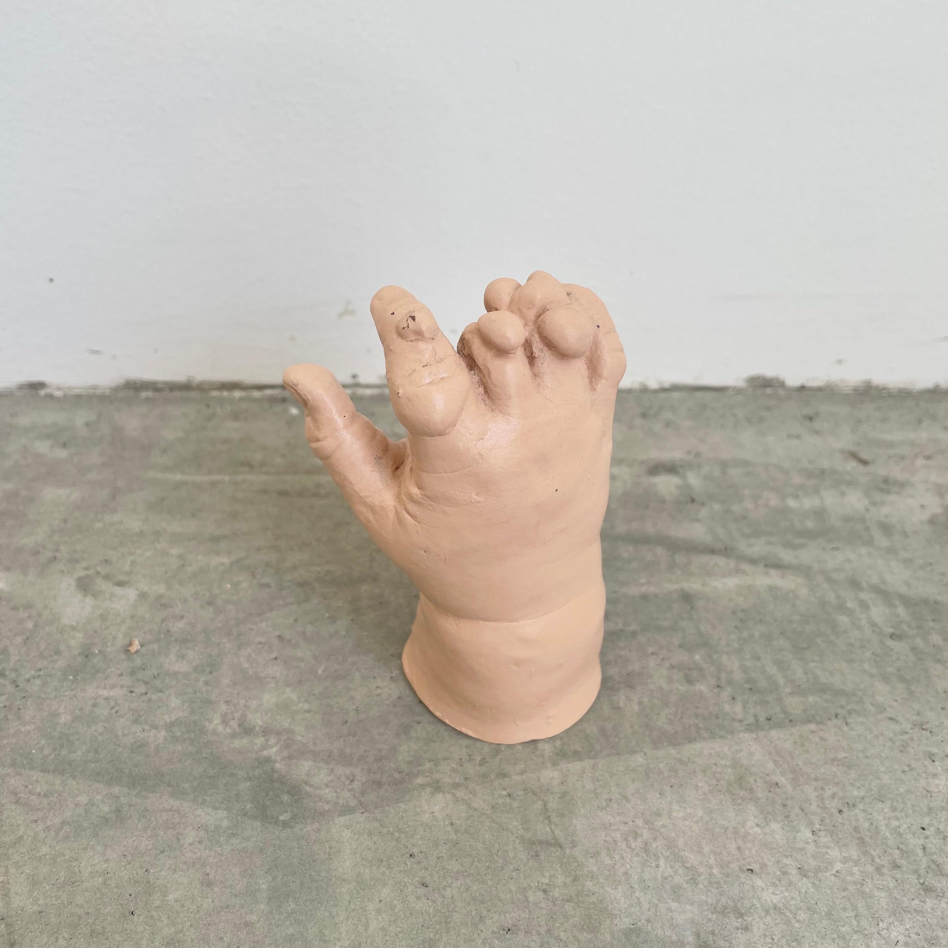 Six Anatomical Castings of Deformed Hands, 1960s USA For Sale 3