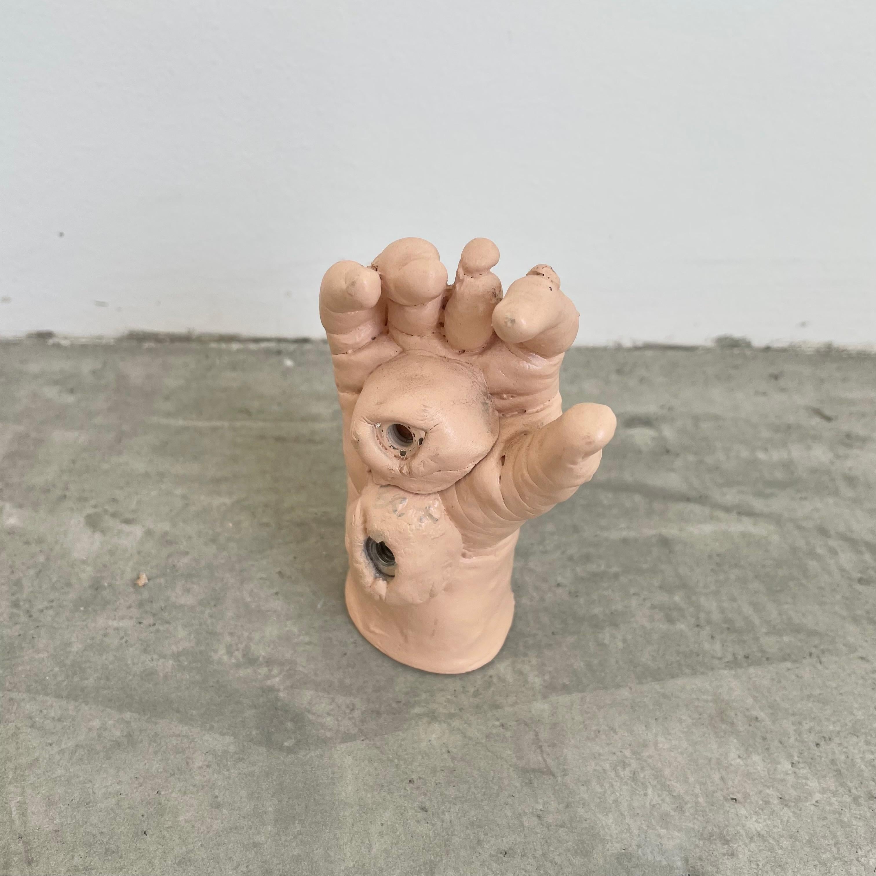 Six Anatomical Castings of Deformed Hands, 1960s USA For Sale 4