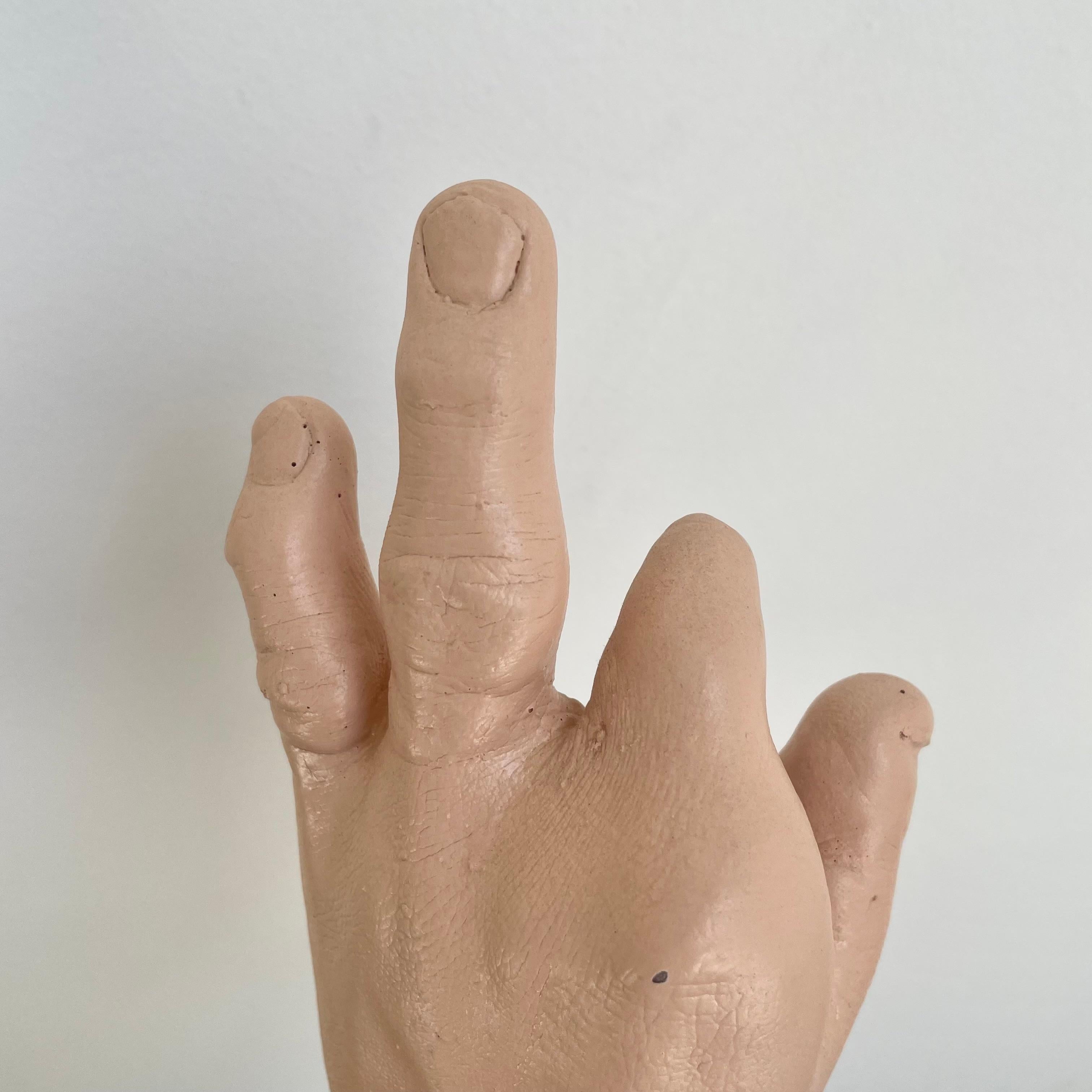 Six Anatomical Castings of Deformed Hands, 1960s USA For Sale 9