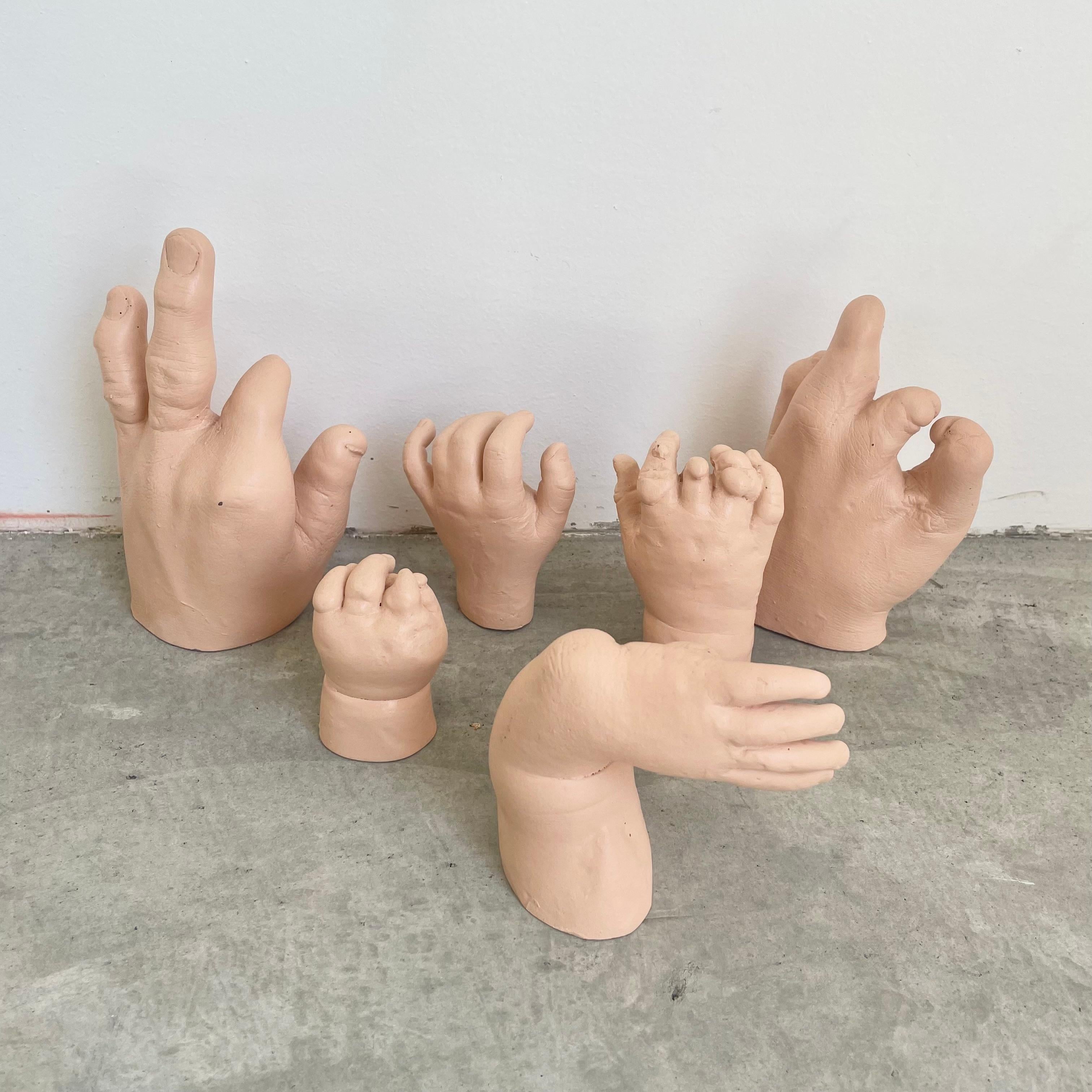 Six anatomical plaster casts of deformed hands.

No provenance, however it seems likely they were used for anatomical studies or in a museum - the Boston Science Museum has some very similar casts on display.

All hand painted in skin tone colour