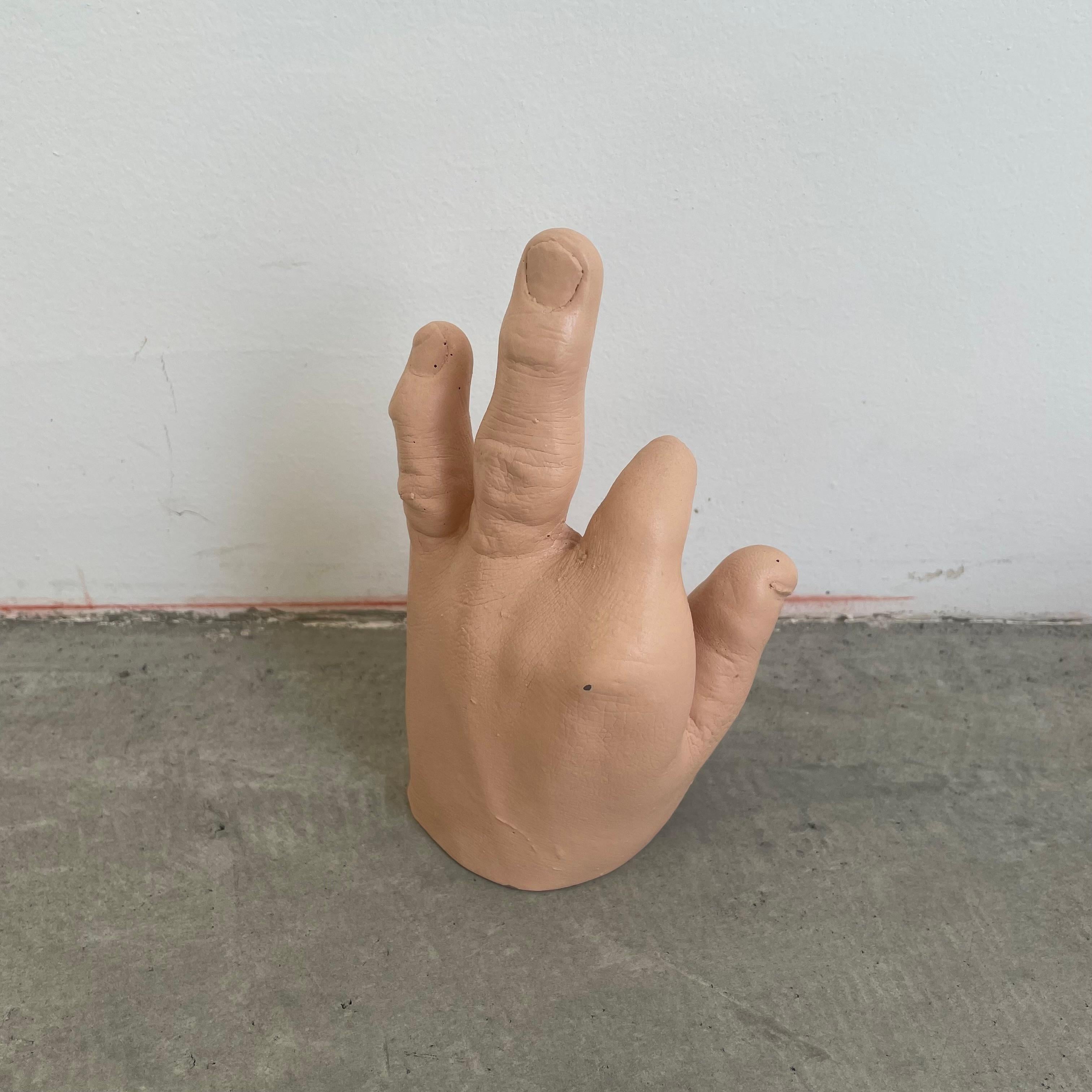disfigured hand