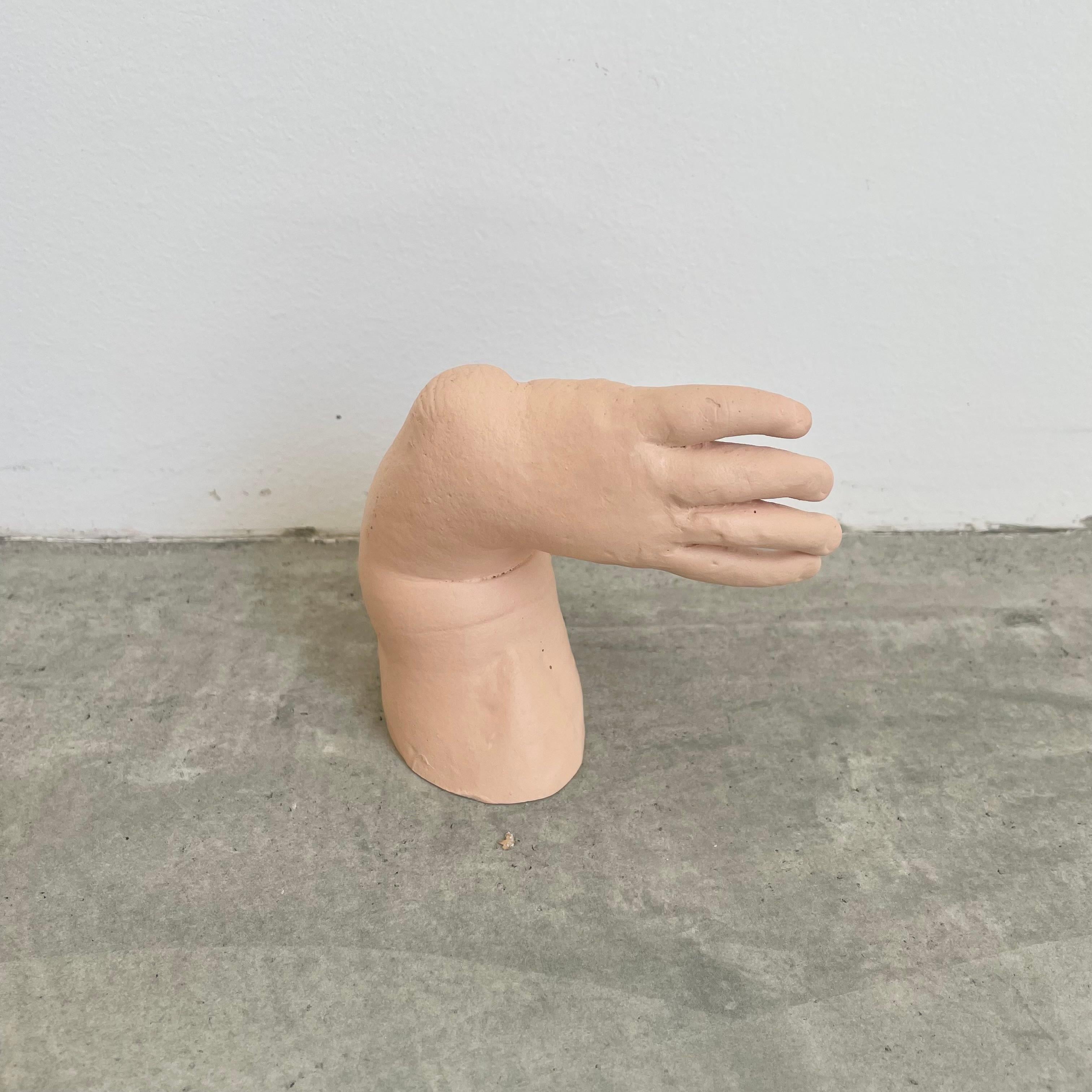 American Six Anatomical Castings of Deformed Hands, 1960s USA For Sale