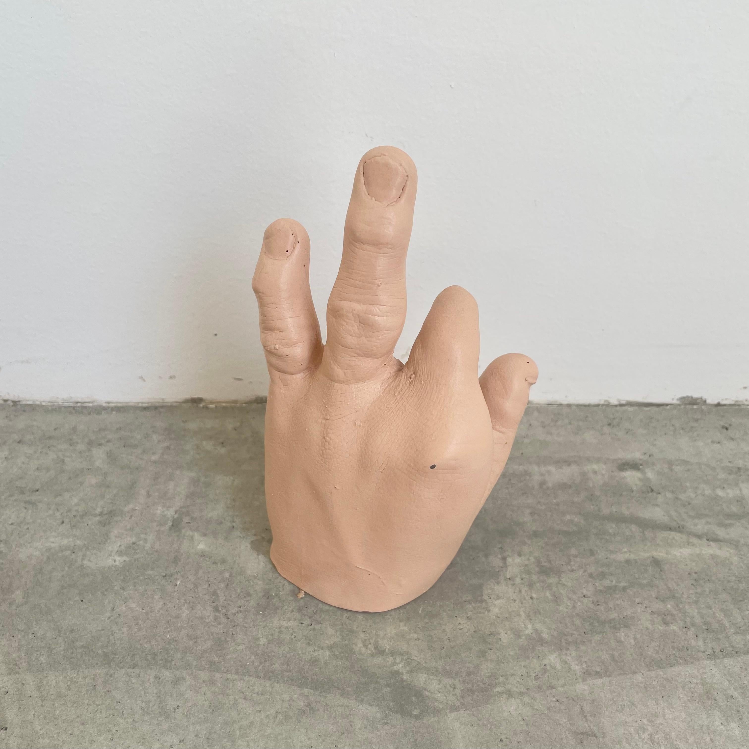 20th Century Six Anatomical Castings of Deformed Hands, 1960s USA For Sale