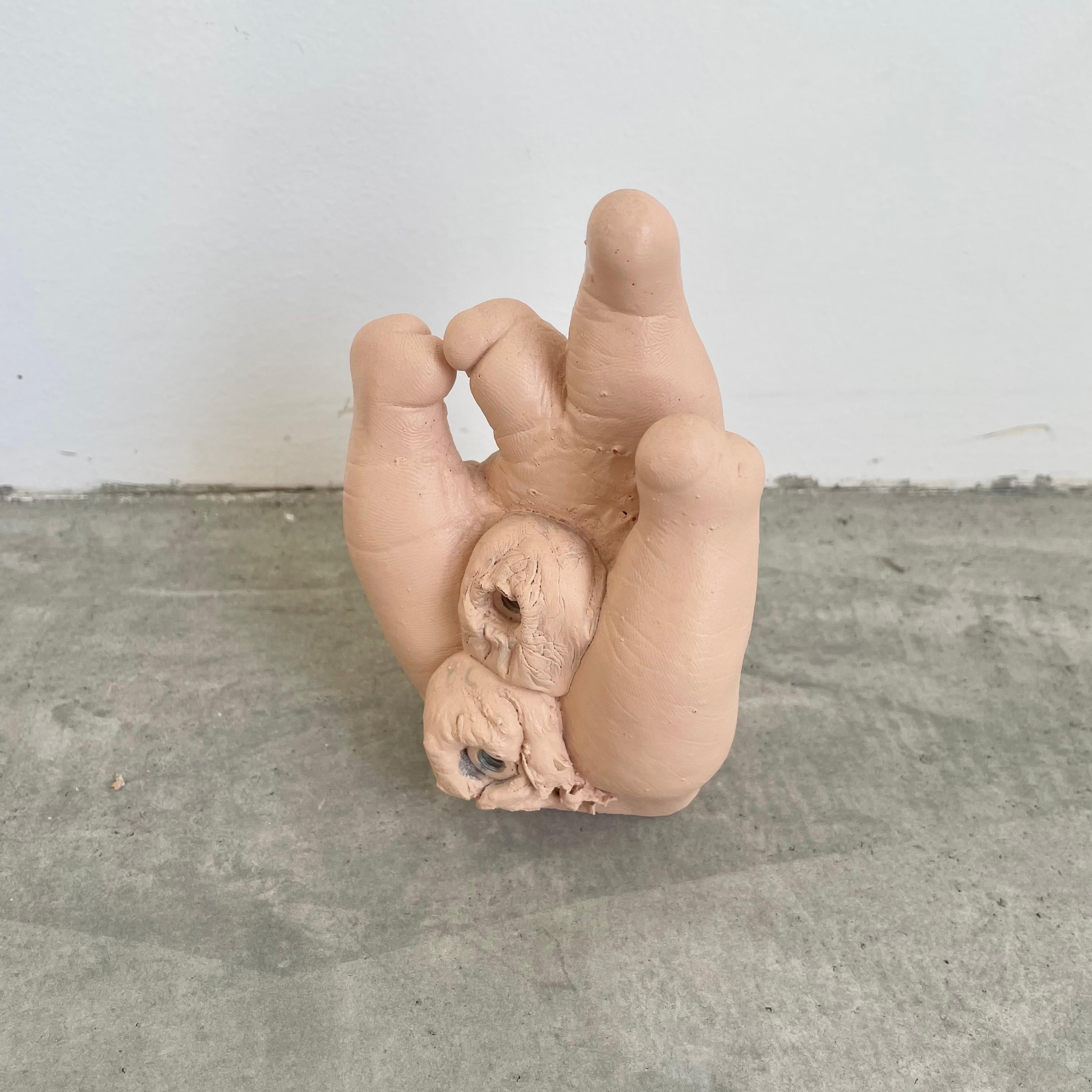 Six Anatomical Castings of Deformed Hands, 1960s USA For Sale 2