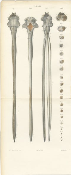 Il midollo spinale e le sue sezioni seriali, tavola a doppia piega di Hirschfeld, 1866
