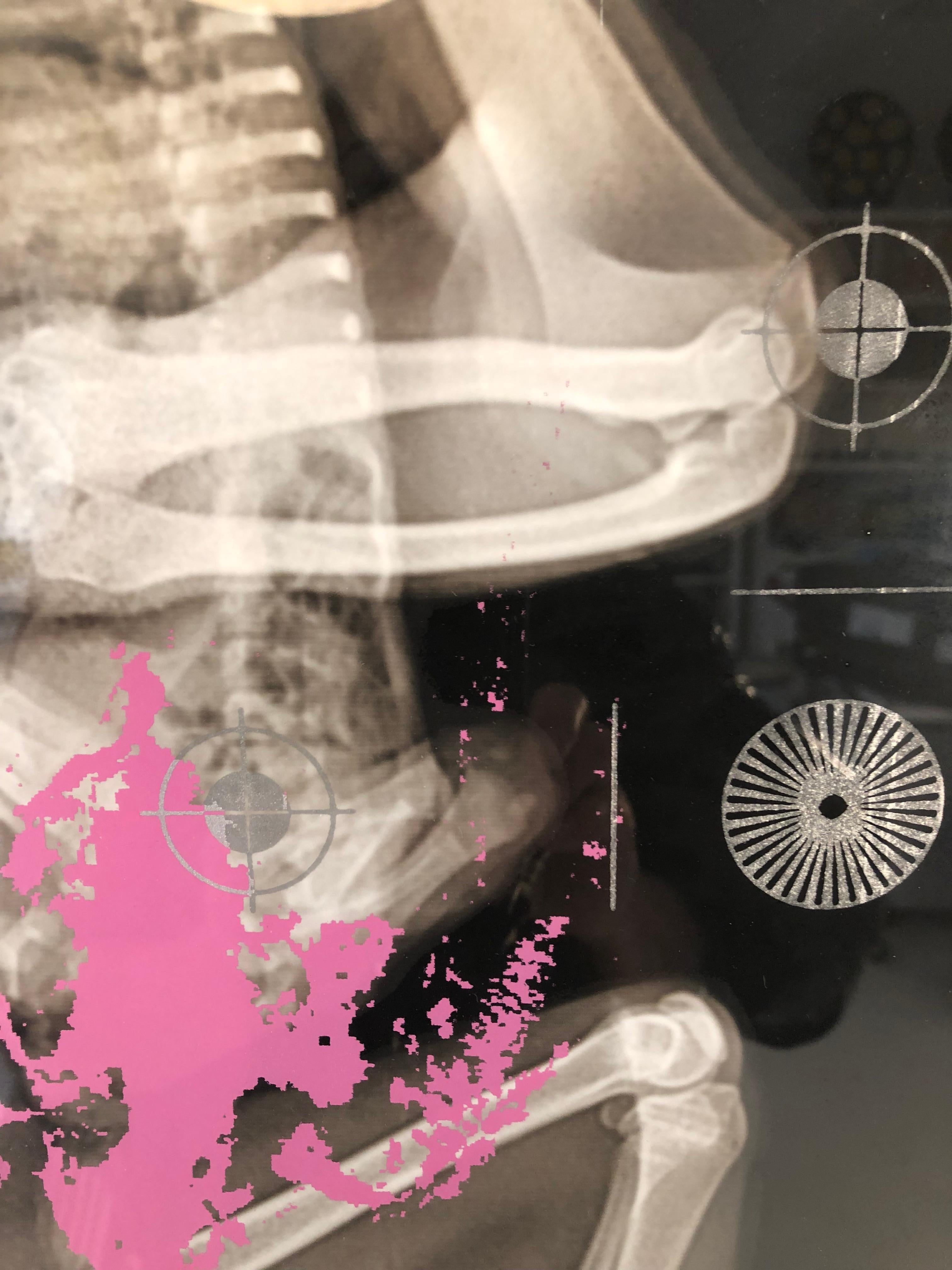 « La santé de la planète n° 709 »  Les escargots « Mother child sloths » sont des œuvres graphiques roses et noires en vente 1