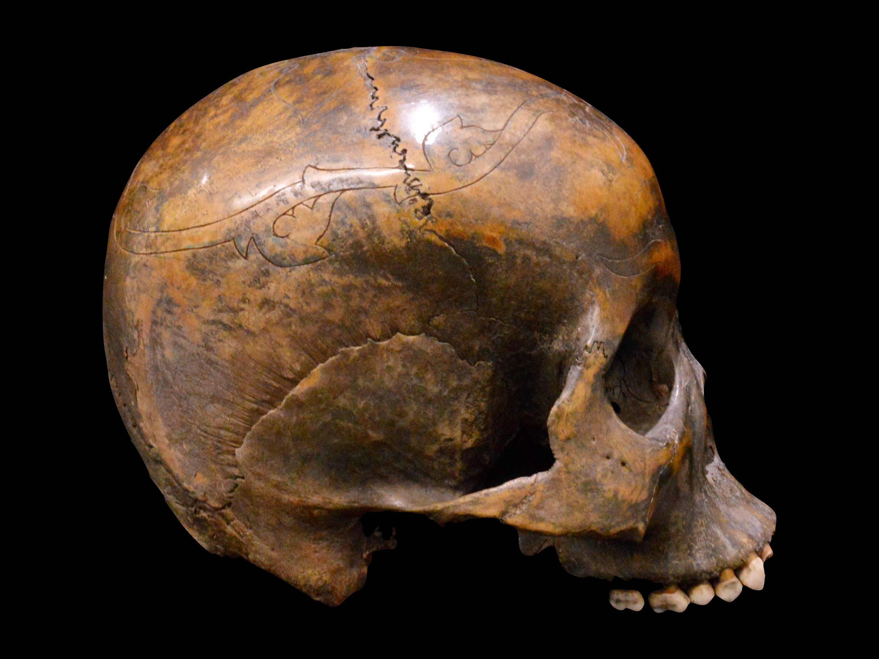guy missing half skull