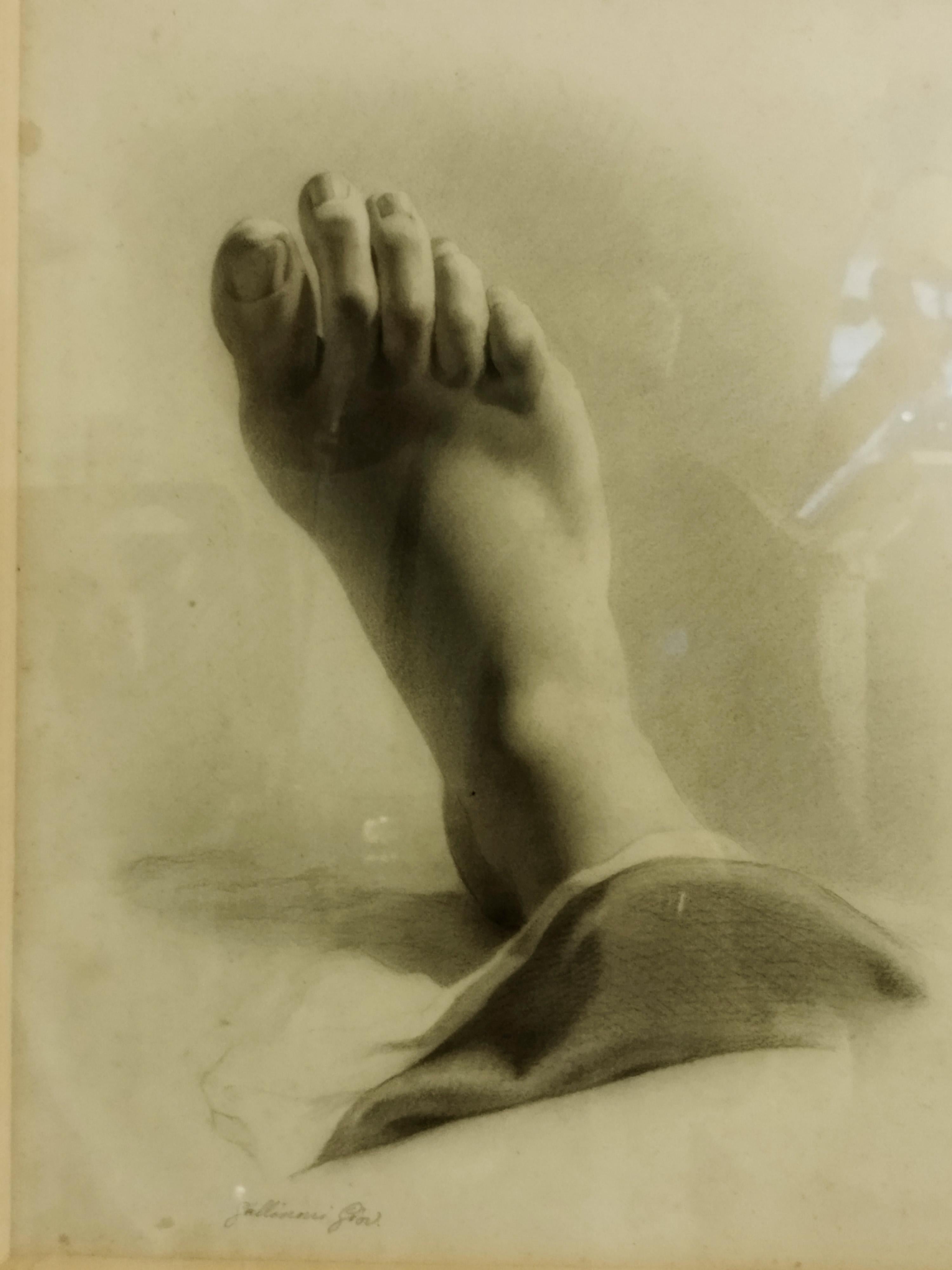 Drawing on paper of anatomical study of a right foot. Work attributed to Gallinoni as it is signed at lower right (see photo). Estimated period first half of the 20th century. Drawing dimensions 34x33 cm.