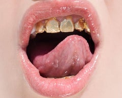Golden Teeth, close-up of golden teeth, Fine Art Photography