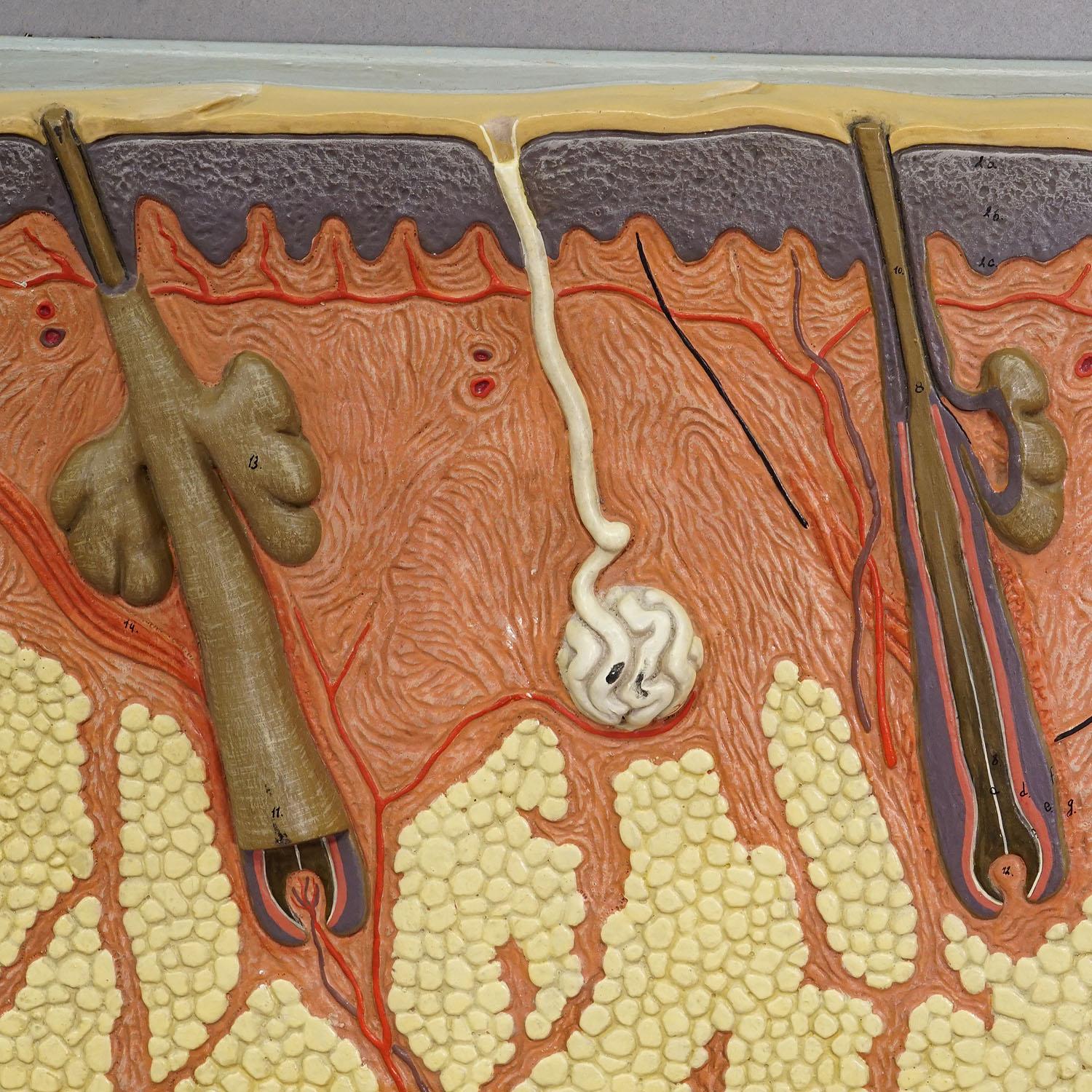 Teaching Aid Showpiece - Structure of the Human Skin, Resin on Wood 1950s In Good Condition For Sale In Berghuelen, DE