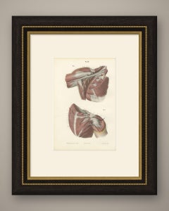 The Axilla and the Cords of the Plexus, Antique Hirschfeld Anatomy Print, 1866