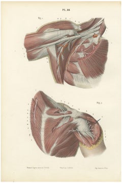 The Axilla and the Cords of the Plexus, Antique Hirschfeld Anatomy Print, 1866