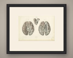 The Base of the Brain Dissected, Antique Hirschfeld Anatomy Print, 1866