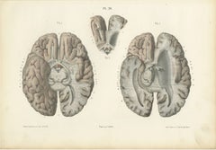 The Base of the Brain Dissected, Antique Hirschfeld Anatomy Print, 1866