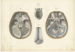 The Base of the Skull and Its Dural Folds, Hirschfeld Anatomy Print, 1866
