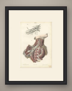 The Brachial Plexus, Antique Hirschfeld Anatomy Print, 1866