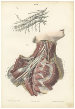 The Brachial Plexus, Antique Hirschfeld Anatomy Print, 1866