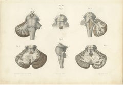 The Brain Stem and Cerebellum, Antique Hirschfeld Anatomy Print, 1866