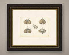 The Cerebellum, Antique Hirschfeld Anatomy Print, 1866