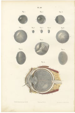 The Crystalline Lens, Antique Hirschfeld Anatomy Print, 1866