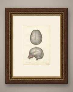 The Dura Mater of the Brain, Antique Hirschfeld Anatomy Print, 1866
